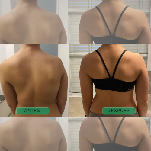 Corrector de Postura al instante